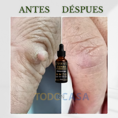 ANTIWARTS ©️ Tumba Verrugas X 2unidades
